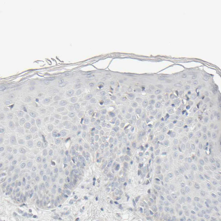 Immunohistochemistry (Formalin/PFA-fixed paraffin-embedded sections) - Anti-RIDA antibody (AB224447)