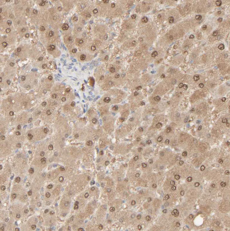 Immunohistochemistry (Formalin/PFA-fixed paraffin-embedded sections) - Anti-RIDA antibody (AB224447)