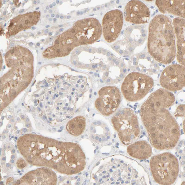 Immunohistochemistry (Formalin/PFA-fixed paraffin-embedded sections) - Anti-RIDA antibody (AB224447)