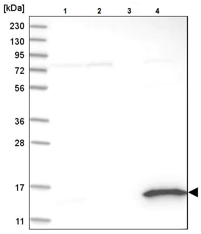 Western blot - Anti-RIDA antibody (AB224447)
