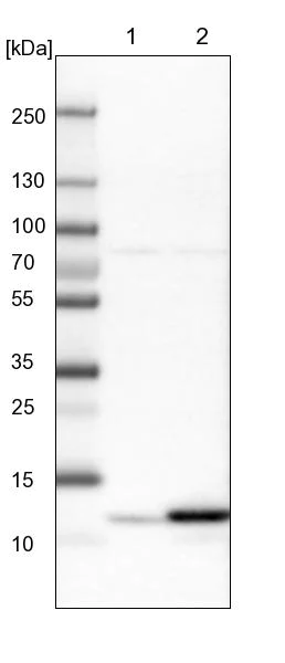 Western blot - Anti-RIDA antibody (AB224447)