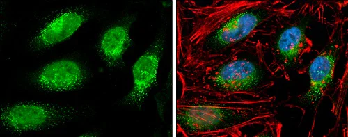 Immunocytochemistry/ Immunofluorescence - Anti-Rif1 antibody (AB229632)