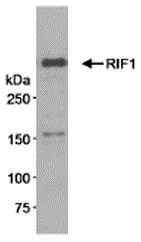 Immunoprecipitation - Anti-Rif1 antibody (AB70254)