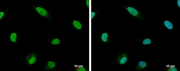 Immunocytochemistry/ Immunofluorescence - Anti-Rif1 antibody - C-terminal (AB229656)