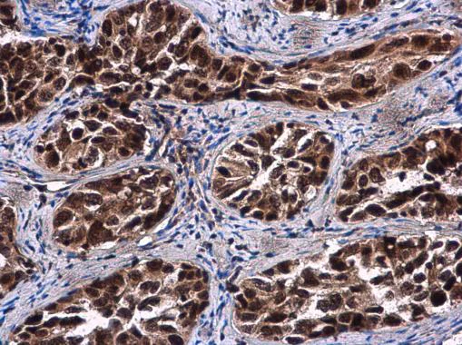 Immunohistochemistry (Formalin/PFA-fixed paraffin-embedded sections) - Anti-Rif1 antibody - C-terminal (AB229656)