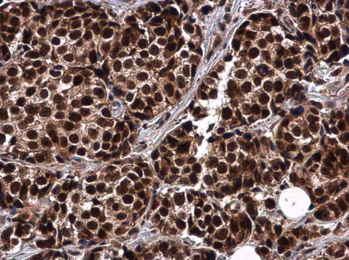 Immunohistochemistry (Formalin/PFA-fixed paraffin-embedded sections) - Anti-Rif1 antibody - C-terminal (AB229656)