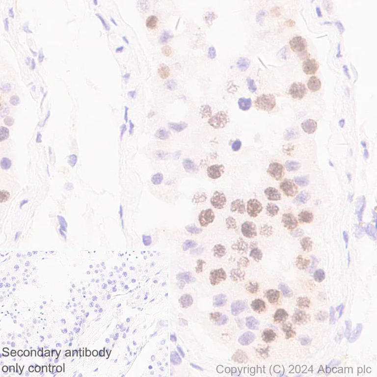 Immunohistochemistry (Formalin/PFA-fixed paraffin-embedded sections) - Anti-Rif1 antibody [EPR27131-83] - BSA and Azide free (AB316749)