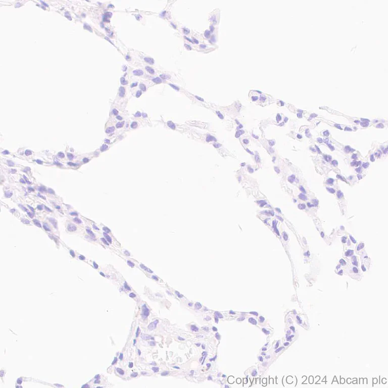 Immunohistochemistry (Formalin/PFA-fixed paraffin-embedded sections) - Anti-Rif1 antibody [EPR27131-83] - BSA and Azide free (AB316749)