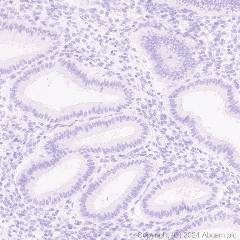 Immunohistochemistry (Formalin/PFA-fixed paraffin-embedded sections) - Anti-Rif1 antibody [EPR27131-83] - BSA and Azide free (AB316749)