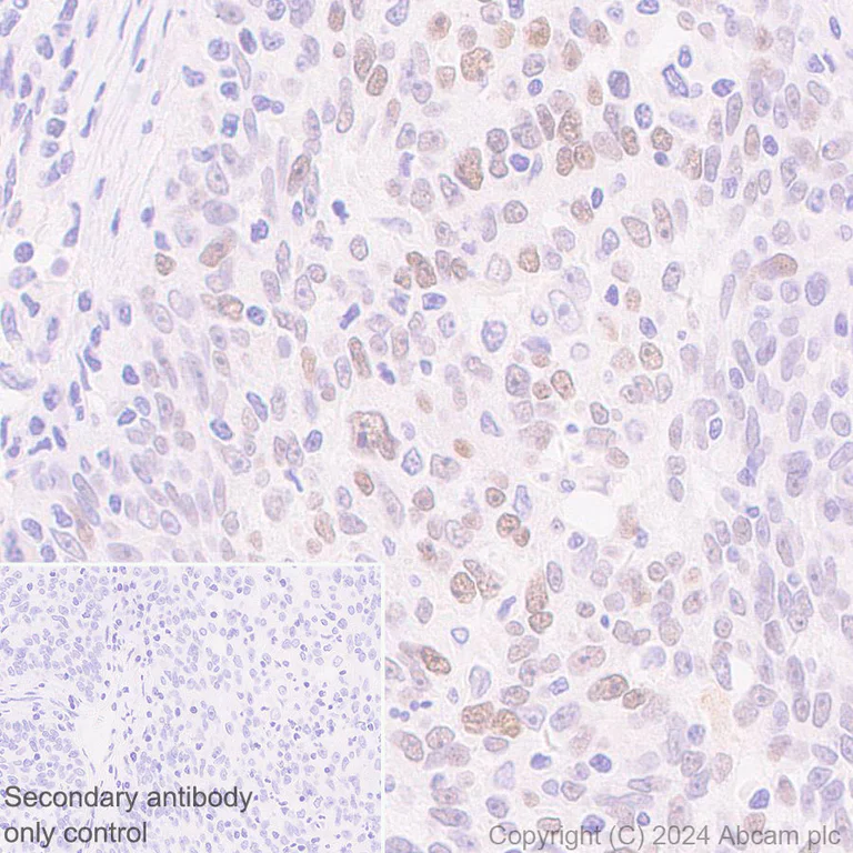 Immunohistochemistry (Formalin/PFA-fixed paraffin-embedded sections) - Anti-Rif1 antibody [EPR27131-83] - BSA and Azide free (AB316749)