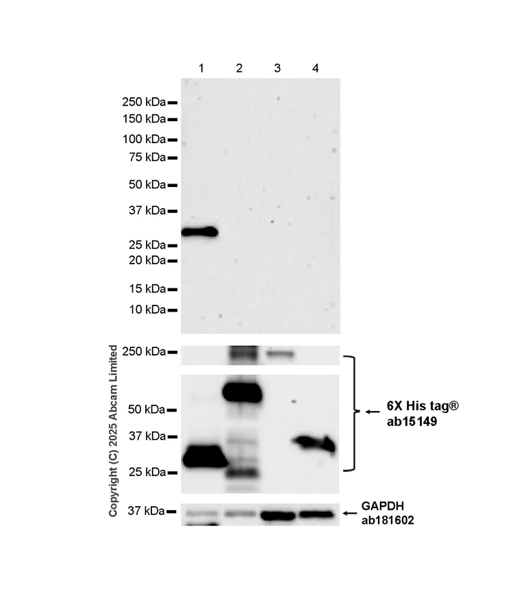 Western blot - Anti-Rift Valley Fever Virus Nucleoprotein antibody [AA11] (AB325011)