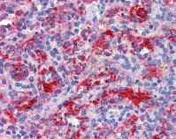 Immunohistochemistry (Formalin/PFA-fixed paraffin-embedded sections) - Anti-RIG-I/DDX58 antibody (AB111037)