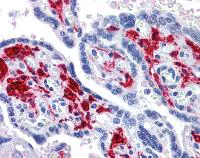 Immunohistochemistry (Formalin/PFA-fixed paraffin-embedded sections) - Anti-RIG-I/DDX58 antibody (AB111037)