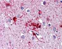 Immunohistochemistry (Formalin/PFA-fixed paraffin-embedded sections) - Anti-RIG-I/DDX58 antibody (AB111037)