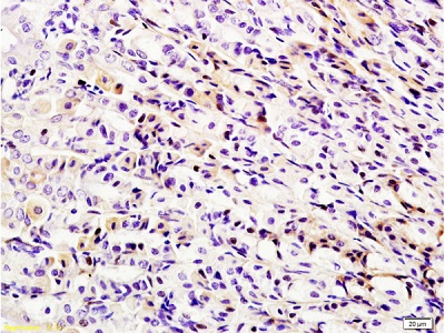 Immunohistochemistry (Formalin/PFA-fixed paraffin-embedded sections) - Anti-RIG-I/DDX58 antibody (AB216679)