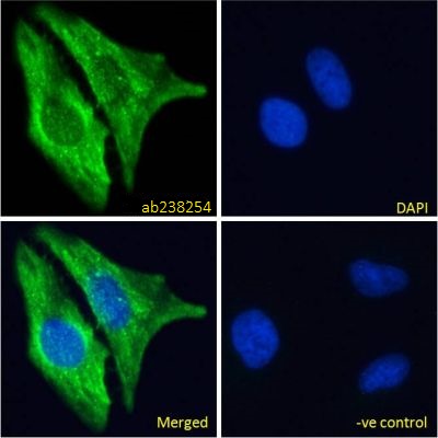 Immunocytochemistry/ Immunofluorescence - Anti-RIG-I/DDX58 antibody (AB238254), expandable thumbnail