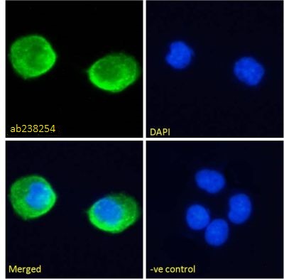 Immunocytochemistry/ Immunofluorescence - Anti-RIG-I/DDX58 antibody (AB238254), expandable thumbnail