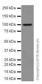 Western blot - Anti-RIG-I/DDX58 antibody [EPR18629] (AB180675)