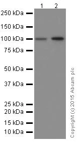 Western blot - Anti-RIG-I/DDX58 antibody [EPR18629] (AB180675)