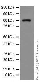 Western blot - Anti-RIG-I/DDX58 antibody [EPR18629] (AB180675)