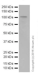 Western blot - Anti-RIG-I/DDX58 antibody [EPR18629] (AB180675)