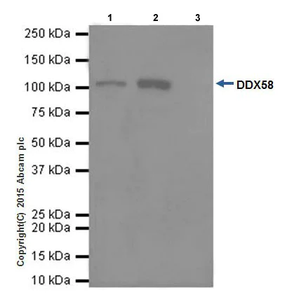 Immunoprecipitation - Anti-RIG-I/DDX58 antibody [EPR18629] - BSA and Azide free (AB240230)