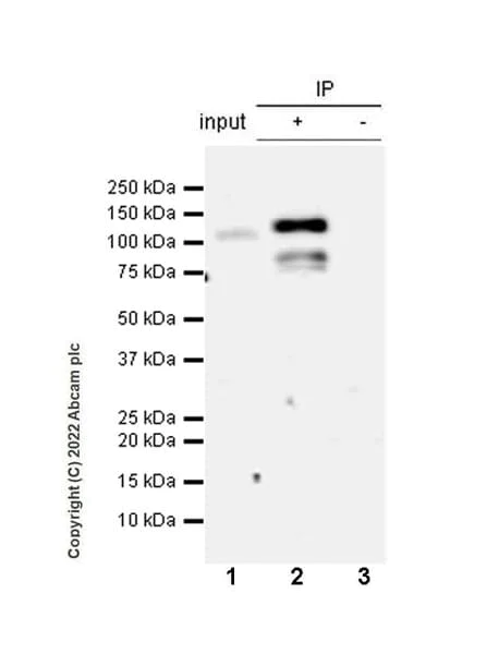 Immunoprecipitation - Anti-RIG-I/DDX58 antibody [EPR26465-40] (AB302778)