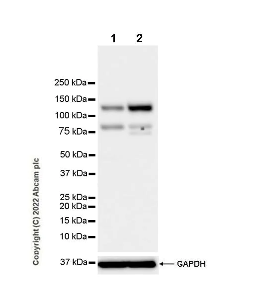 Western blot - Anti-RIG-I/DDX58 antibody [EPR26465-40] (AB302778)