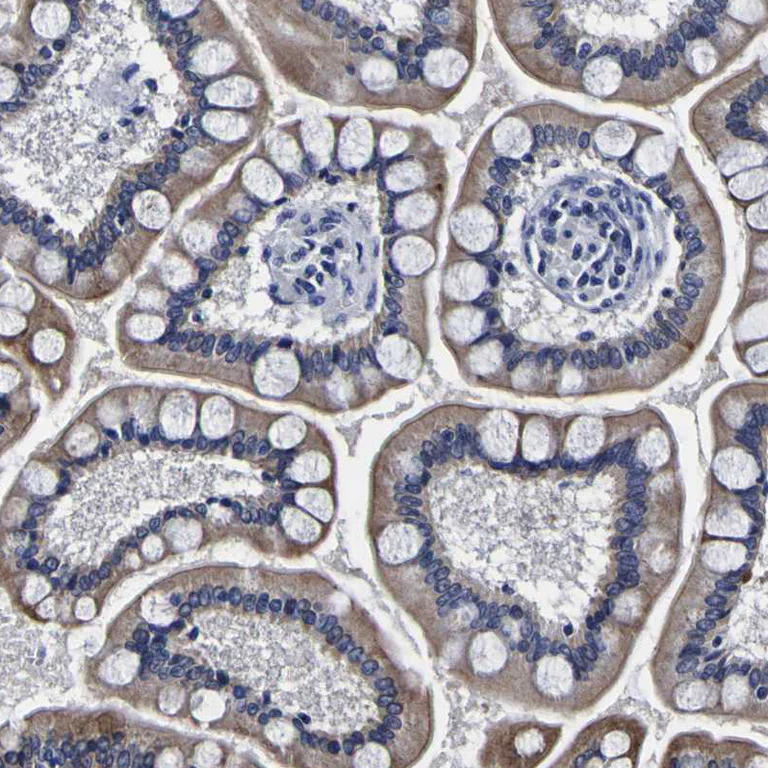 Immunohistochemistry (Formalin/PFA-fixed paraffin-embedded sections) - Anti-RIL antibody (AB251701)