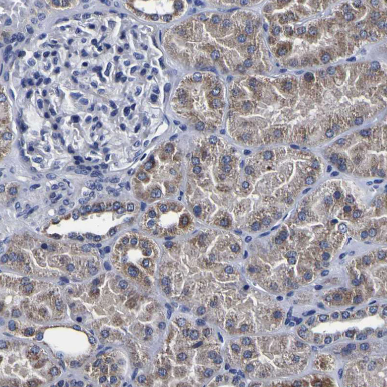Immunohistochemistry (Formalin/PFA-fixed paraffin-embedded sections) - Anti-RIL antibody (AB251701)