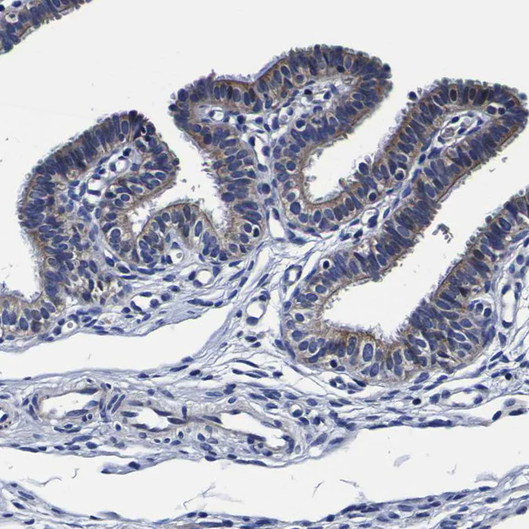 Immunohistochemistry (Formalin/PFA-fixed paraffin-embedded sections) - Anti-RIL antibody (AB251701)