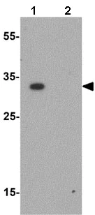 Western blot - Anti-RILP antibody (AB140188)