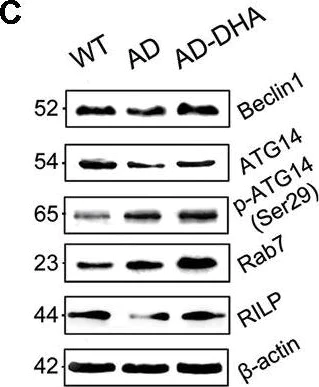 Western blot - Anti-RILP antibody (AB140188)