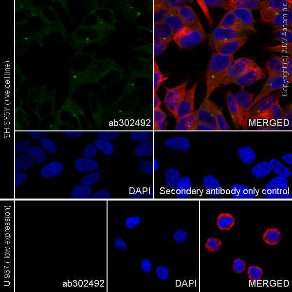 Immunocytochemistry/ Immunofluorescence - Anti-RILPL1 antibody [MJF-R41-21] (AB302492)