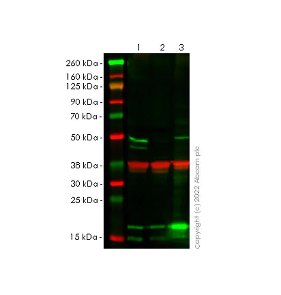 Western blot - Anti-RILPL1 antibody [MJF-R41-21] (BSA and Azide free) (AB302493)
