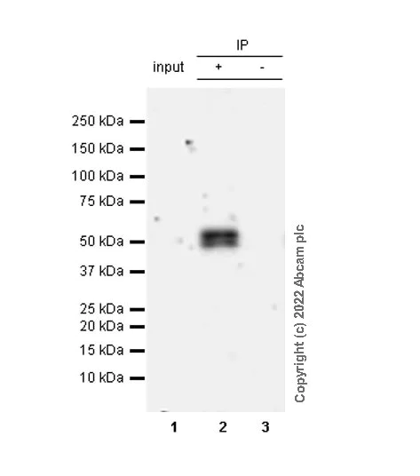Immunoprecipitation - Anti-RILPL1 antibody [MJF-R41-21] - Mouse IgG2a (Chimeric) - BSA and Azide free (AB307295)