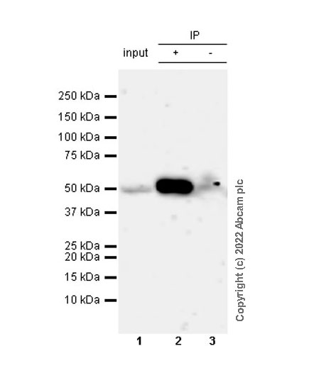 Immunoprecipitation - Anti-RILPL1 antibody [MJF-R41-21] - Mouse IgG2a (Chimeric) - BSA and Azide free (AB307295), expandable thumbnail