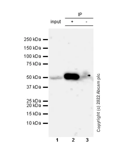 Immunoprecipitation - Anti-RILPL1 antibody [MJF-R41-21] - Mouse IgG2a (Chimeric) - BSA and Azide free (AB307295)