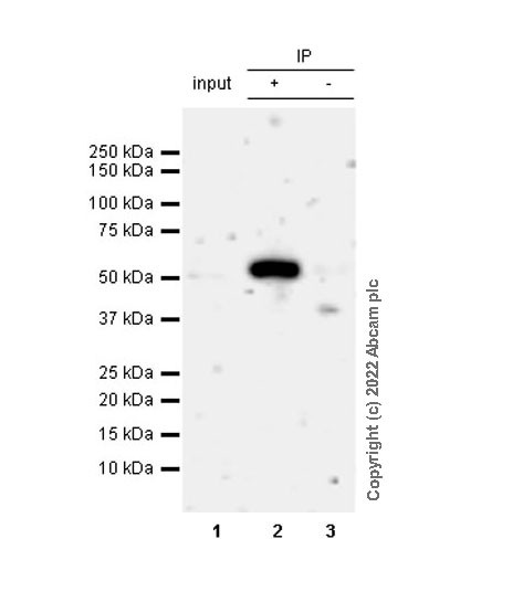 Immunoprecipitation - Anti-RILPL1 antibody [MJF-R41-21] - Mouse IgG2a (Chimeric) - BSA and Azide free (AB307295), expandable thumbnail