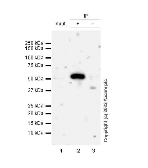 Immunoprecipitation - Anti-RILPL1 antibody [MJF-R41-21] - Mouse IgG2a (Chimeric) - BSA and Azide free (AB307295)