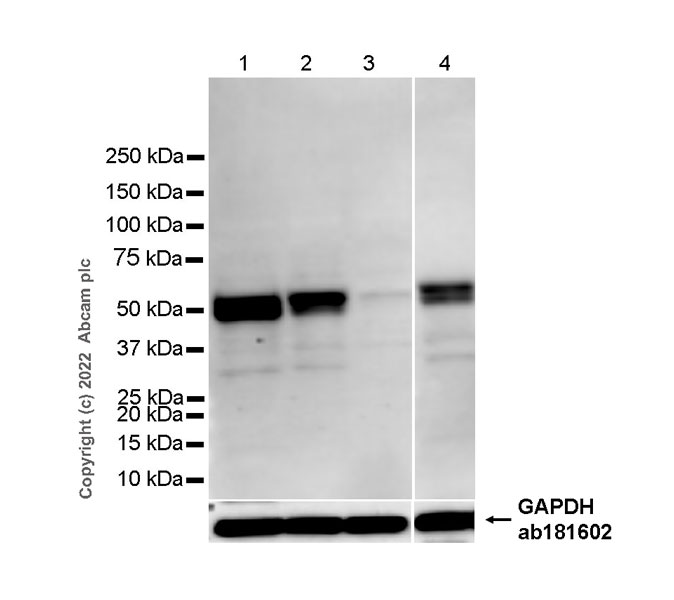 Western blot - Anti-RILPL1 antibody [MJF-R41-21] - Mouse IgG2a (Chimeric) - BSA and Azide free (ab307295), expandable thumbnail