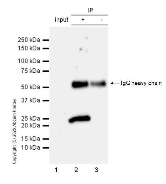 Immunoprecipitation - Anti-RILPL2 antibody [EPR29763-69] - BSA and Azide free (AB326586)
