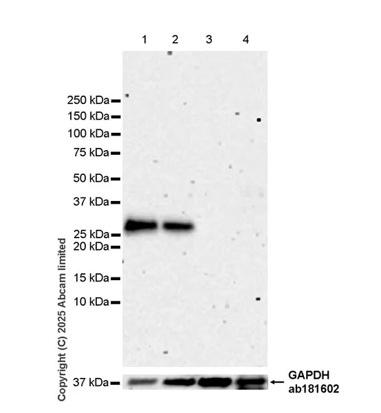 Western blot - Anti-RILPL2 antibody [EPR29763-69] - BSA and Azide free (AB326586)