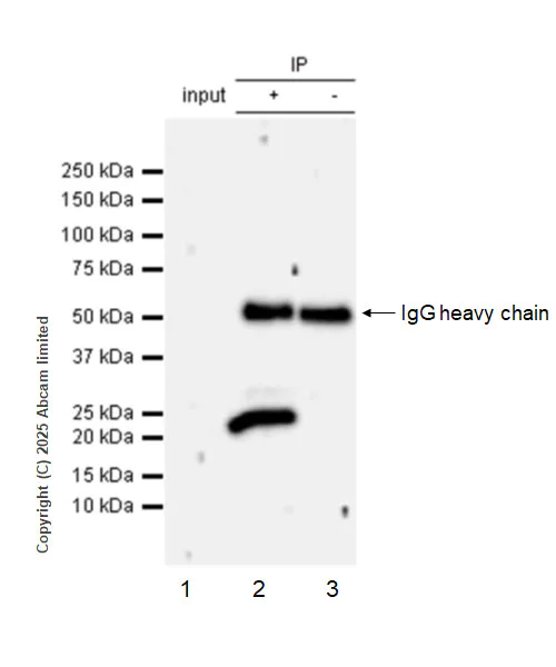 Immunoprecipitation - Anti-RILPL2 antibody [MJF-D29763-158] (AB325138)