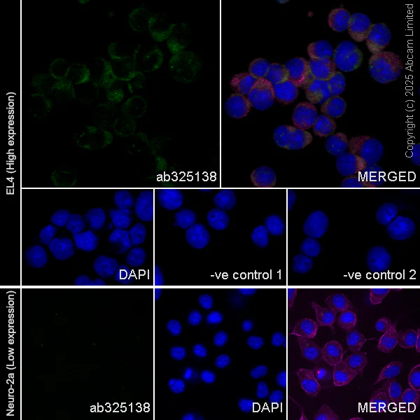 Immunocytochemistry/ Immunofluorescence - Anti-RILPL2 antibody [MJF-D29763-158] - BSA and Azide free (AB326585)