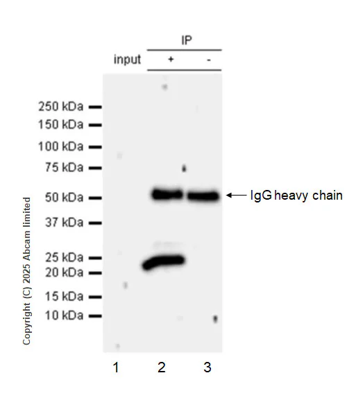 Immunoprecipitation - Anti-RILPL2 antibody [MJF-D29763-158] - BSA and Azide free (AB326585)