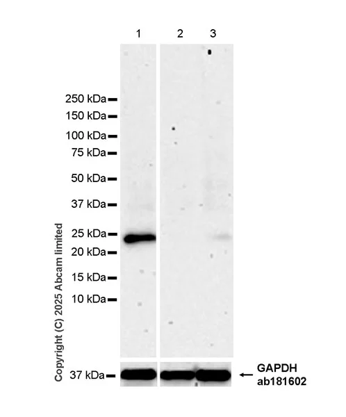 Western blot - Anti-RILPL2 antibody [MJF-D29763-158] - BSA and Azide free (AB326585)