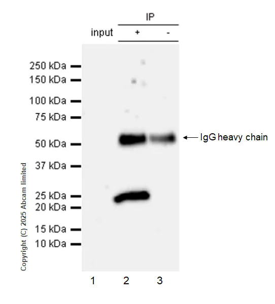 Immunoprecipitation - Anti-RILPL2 antibody [MJF-D29763-69] (AB325436)