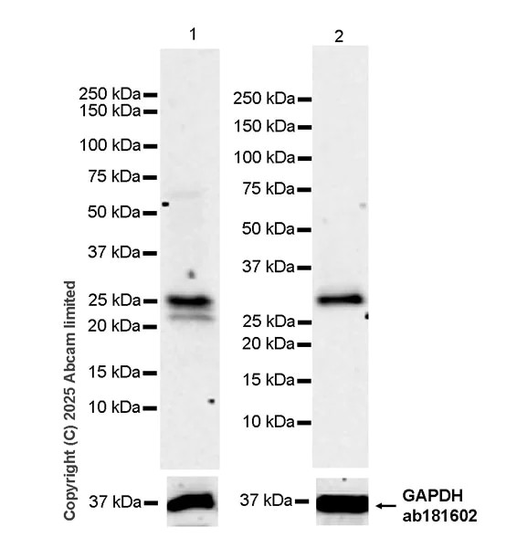 Western blot - Anti-RILPL2 antibody [MJF-D29763-69] (AB325436)
