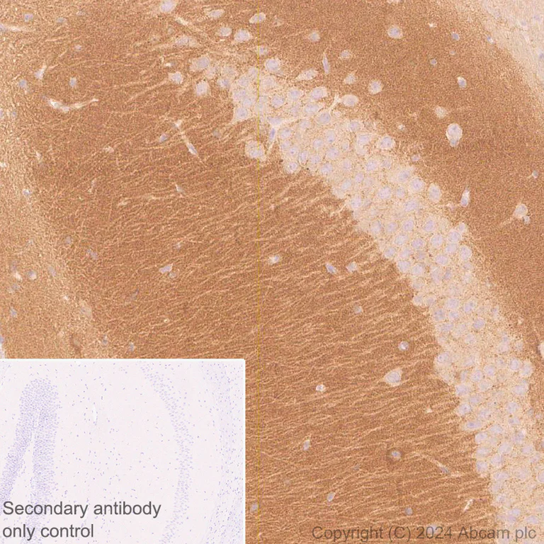 Immunohistochemistry (Formalin/PFA-fixed paraffin-embedded sections) - Anti-RIM1 antibody [EPR29131-30] (AB317450)